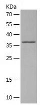    NLRP1 / Recombinant Human NLRP1