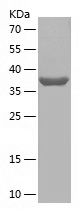    MRPL11 / Recombinant Human MRPL11