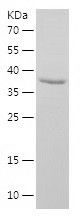    HTRA2 / Recombinant Human HTRA2