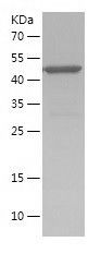    NSDHL / Recombinant Human NSDHL