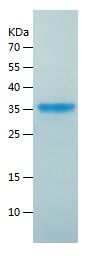    HMGB2 / Recombinant Human HMGB2