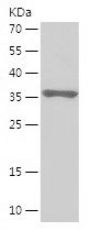    CEBPB / Recombinant Human CEBPB