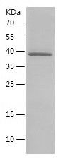    RPL11 / Recombinant Human RPL11