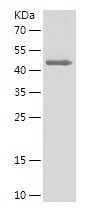    GSTA4 / Recombinant Human GSTA4