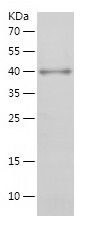    LIFR / Recombinant Human LIFR