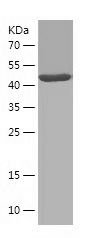    MSRA / Recombinant Human MSRA