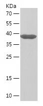    CDKN2D / Recombinant Human CDKN2D