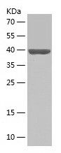    NEIL3 / Recombinant Human NEIL3