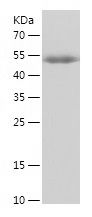    MRTFA / Recombinant Human MRTFA