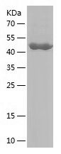    MGAT1 / Recombinant Human MGAT1