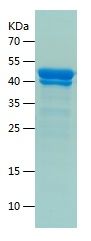    CD248 / Recombinant Human CD248