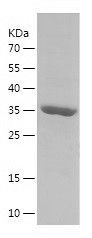    PDLIM1 / Recombinant Human PDLIM1