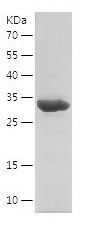    TACO1 / Recombinant Human TACO1