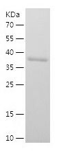    RAD18 / Recombinant Human RAD18