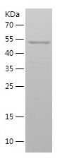    SMYD2 / Recombinant Human SMYD2