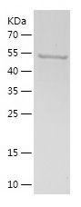    ACSS1 / Recombinant Human ACSS1