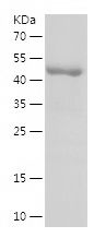    GALC-2 / Recombinant Human GALC-2