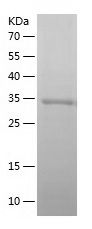    SEC61B / Recombinant Human SEC61B