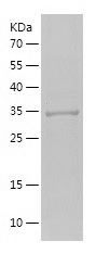    C5AR1 / Recombinant Human C5AR1