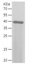    COQ7 / Recombinant Human COQ7