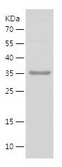    VDAC3 / Recombinant Human VDAC3