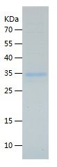    IgE / Recombinant Human IgE