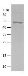    MLYCD / Recombinant Human MLYCD