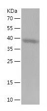    OGG1 / Recombinant Human OGG1