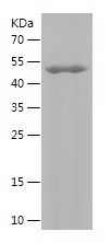    SPHK1 / Recombinant Human SPHK1