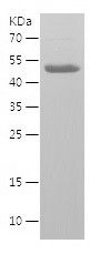    SIRT5 / Recombinant Human SIRT5