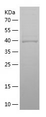    CETN2 / Recombinant Human CETN2