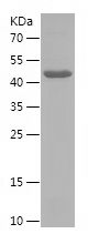    CXXC5 / Recombinant Human CXXC5