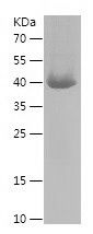    AP3B1 / Recombinant Human AP3B1