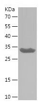    CEP131 / Recombinant Human CEP131