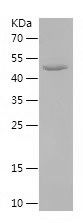    CTNNA3 / Recombinant Human CTNNA3