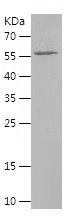    ATP6V1A / Recombinant Human ATP6V1A