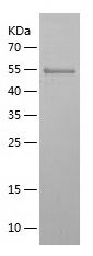    GGCX / Recombinant Human GGCX