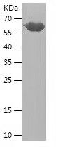    KIF11 / Recombinant Human KIF11