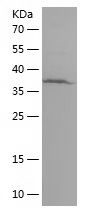    FOSL2 / Recombinant Human FOSL2