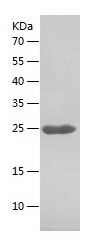    BAG2 / Recombinant Human BAG2