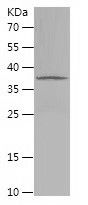    EEF1D / Recombinant Human EEF1D