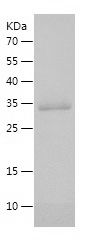    KLK2 / Recombinant Human KLK2