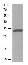    MYH14 / Recombinant Human MYH14