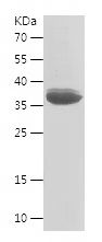    COQ9 / Recombinant Human COQ9