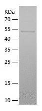    SOX5 / Recombinant Human SOX5