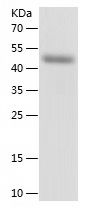    HTRA1 / Recombinant Human HTRA1