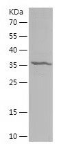    LIG1 / Recombinant Human LIG1