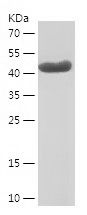    DDX20 / Recombinant Human DDX20