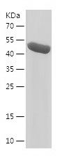    SLC27A4 / Recombinant Human SLC27A4