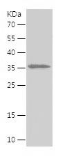    DIO2 / Recombinant Human DIO2